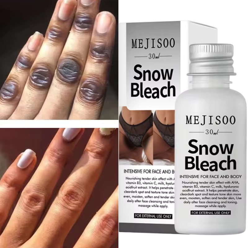 Korean Lifestyle Products - Crème éclaircissante rapide pour les jointures