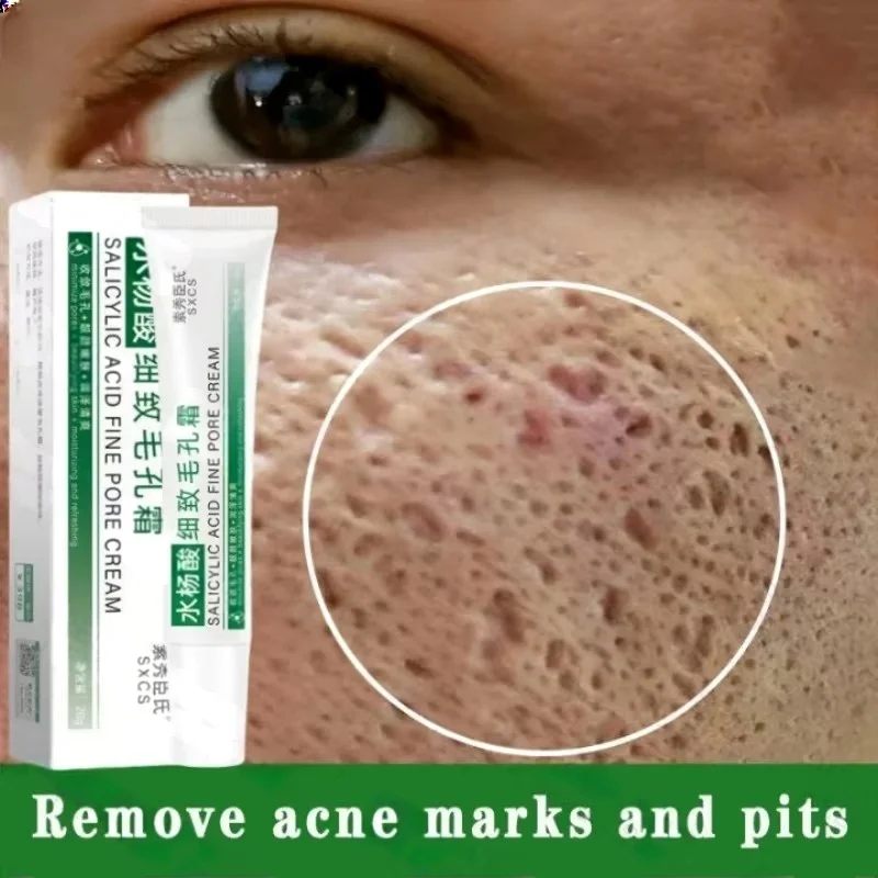 Korean Lifestyle Products - Crème de nettoyage des pores à