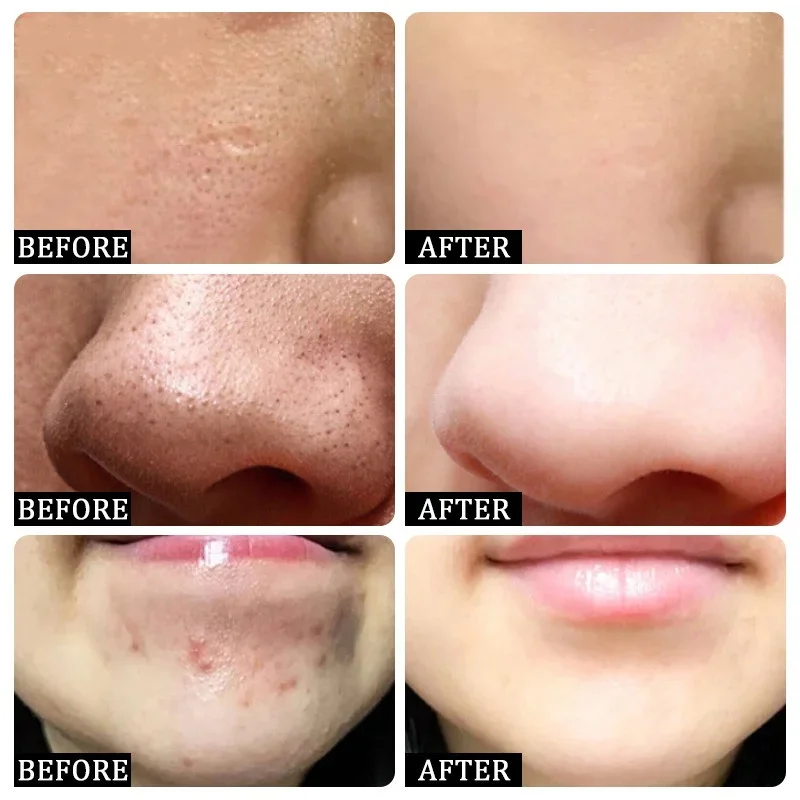 Crème de nettoyage des pores à - Korean Lifestyle Products avis et prix