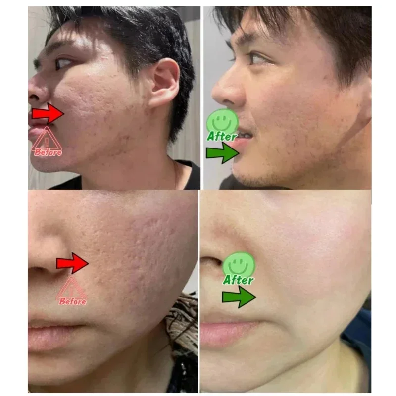 Crème de nettoyage des pores à - Korean Lifestyle Products avis et prix