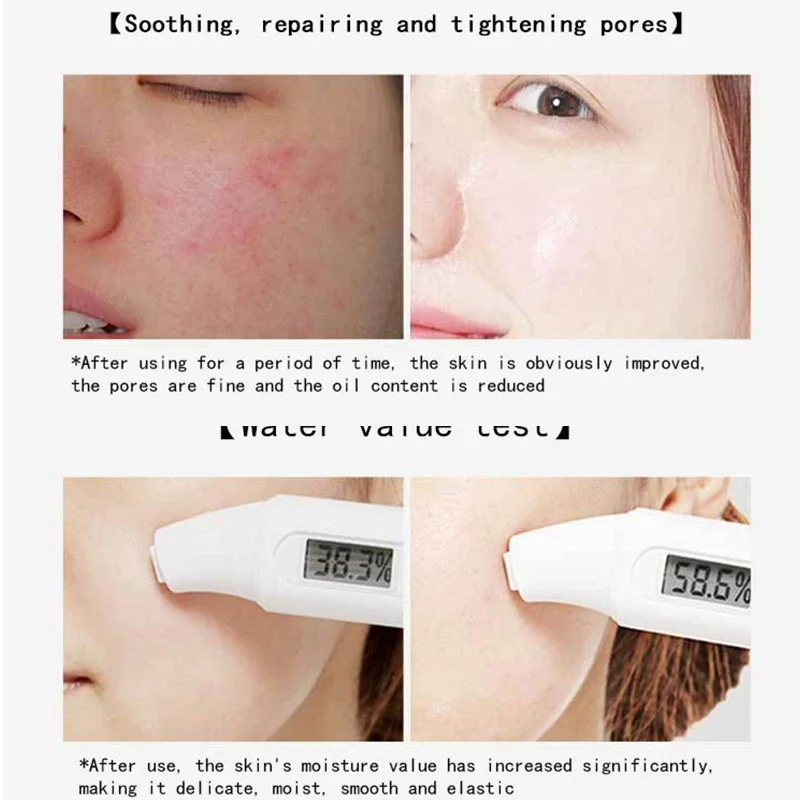 Centella – masques faciaux au  - Korean Lifestyle Products avis et prix