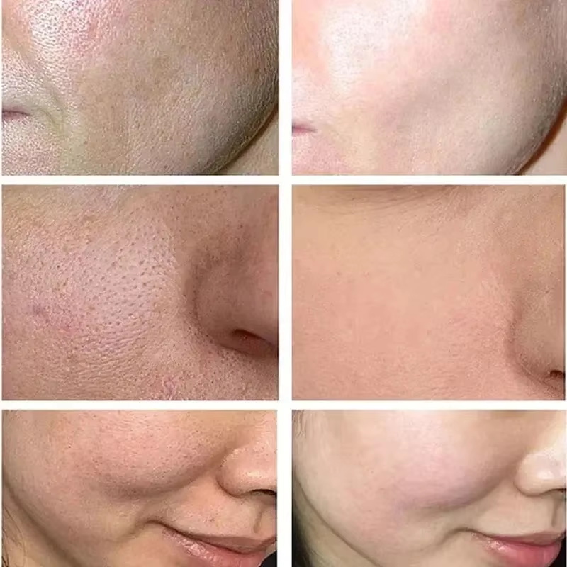 Crème Réductrice de Pores à l' - Korean Lifestyle Products avis et prix